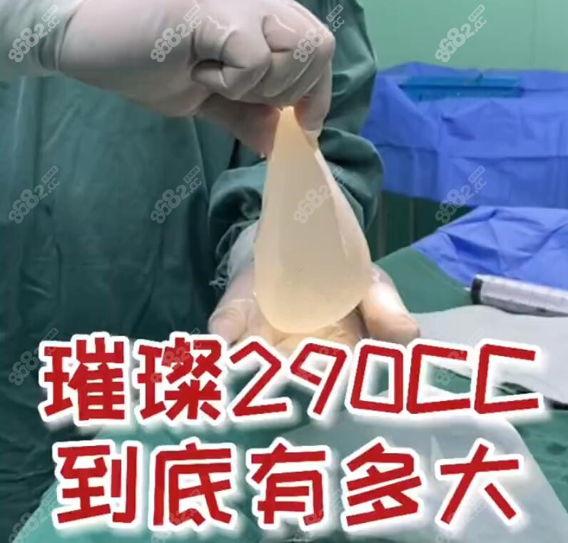 傲诺拉璀璨290cc假体隆胸实例乳房从a变c罩杯躺下也更自然