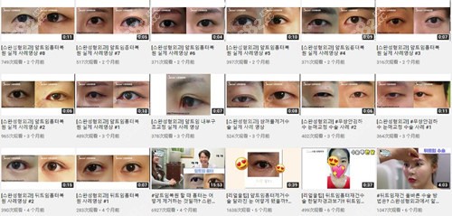 韩国眼睛修复哪家医院好