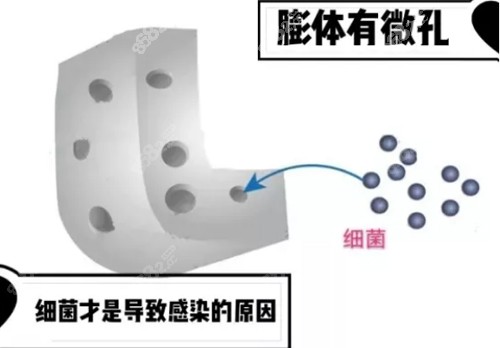 膨体结构示意图