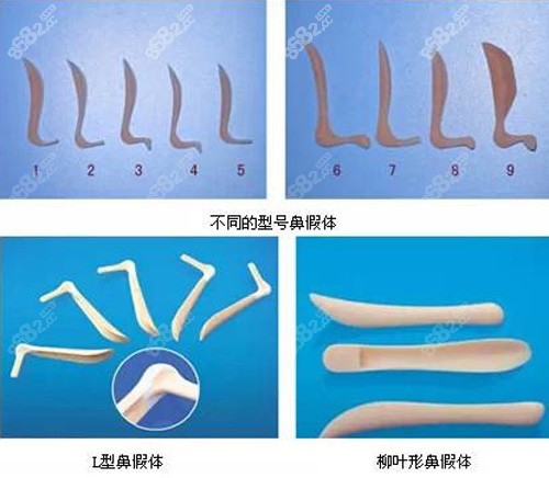 硅胶假体示意图