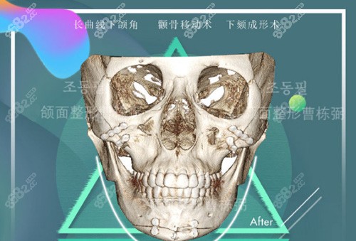 <!--<i data=20240705-sp></i>--><span style=