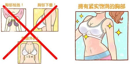女性胸部下垂的几种情况