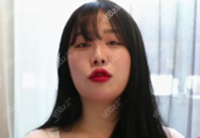 韩国菲斯莱茵整形医院轮廓手术多少钱