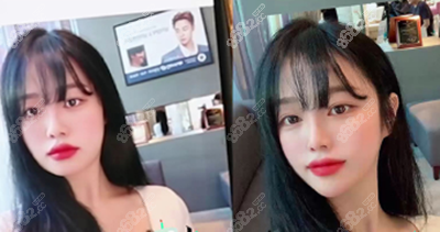 韩国菲斯莱茵整形医院怎么样