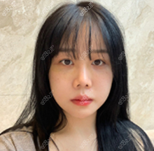 韩国菲斯莱茵整形医院轮廓术前照