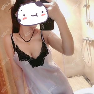 找重庆华美张梅医生做假体隆胸1个月