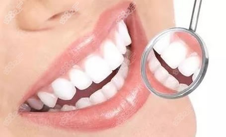 牙齿美白方法洗牙