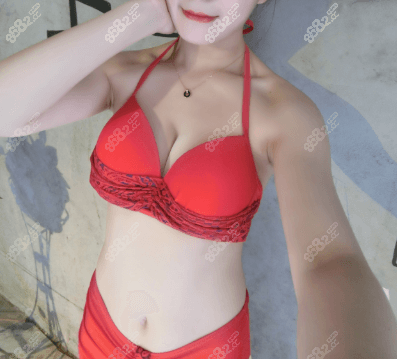 北京画美赵宏伟医生假体隆胸45天效果你感觉怎么样
