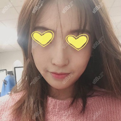 <!--<i data=20240705-sp></i>-->医生给我做半肋骨鼻直鼻微翘款鼻子6个月效果照片