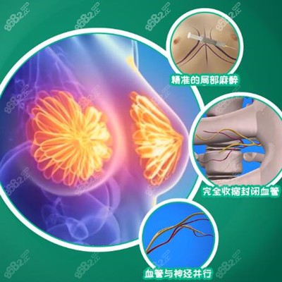 棉花糖丰胸的技术优势