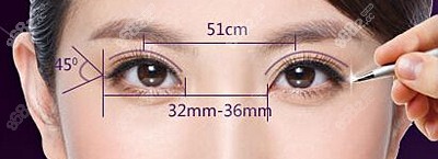 肿泡眼可以做双眼皮改善