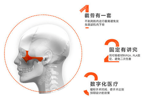 上海薇琳<!--<i data=20240705-sp></i>-->磨骨技术优势示意图