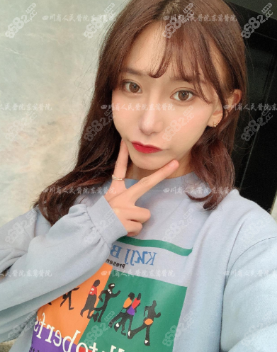 鼻综合术后两个月恢复