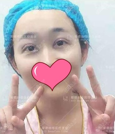 眼综合手术术后即刻 眼综合手术术后即刻