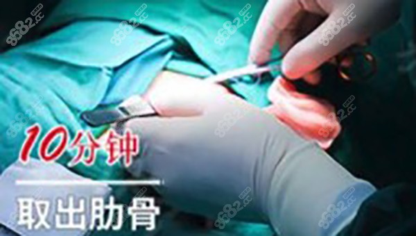 <!--<i data=20240705-sp></i>-->明隆鼻技术取肋骨