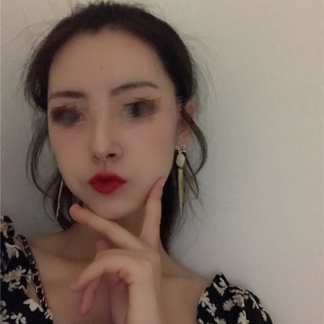 闺蜜推荐佛山苏李秀英面诊后，当天交钱！