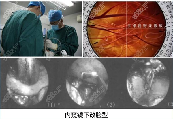 廣州美恩內(nèi)窺鏡改臉型設(shè)備