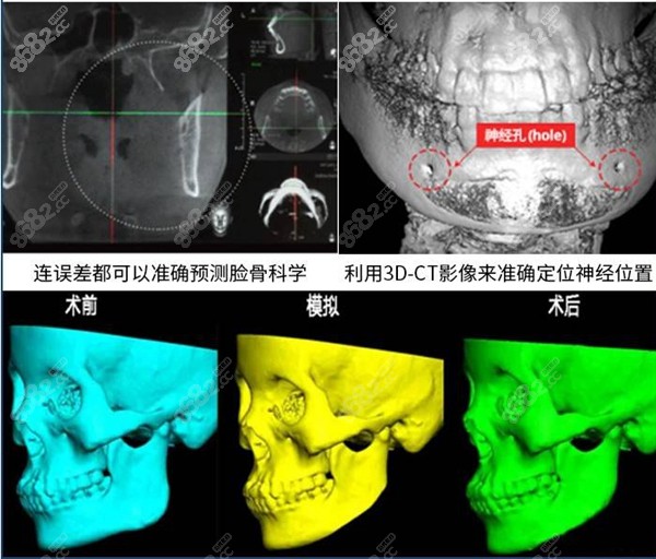 廣州美恩3D-CT影像