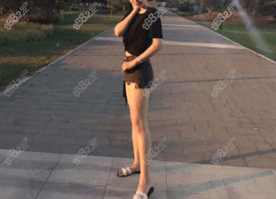 北京艺美王东大小腿抽脂案例
