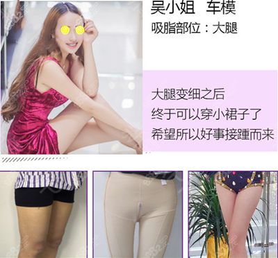 <!--<i data=20240705-sp></i>-->整形全身吸脂塑形真实<span style=