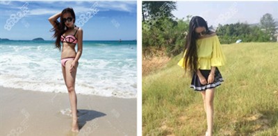 <!--<i data=20240705-sp></i>-->整形全身吸脂塑形真实<span style=