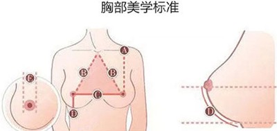 佛山禅中胸部美学标准