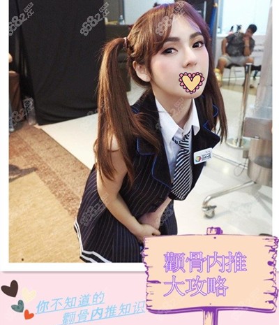 韩国迪美整形面部轮廓热门<span style=