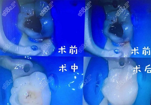 宁夏佳兴口腔诊所补牙<span style=