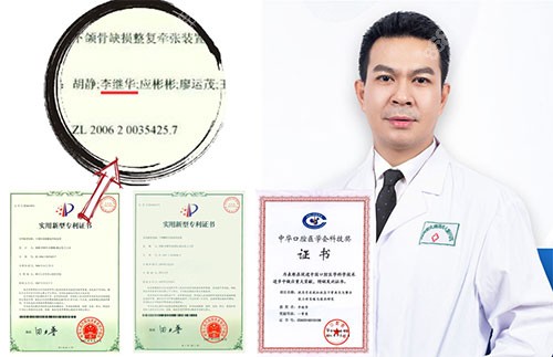 李继华医生是四川大学华西口腔医院的,对于颌面部,口腔的研究十分热爱