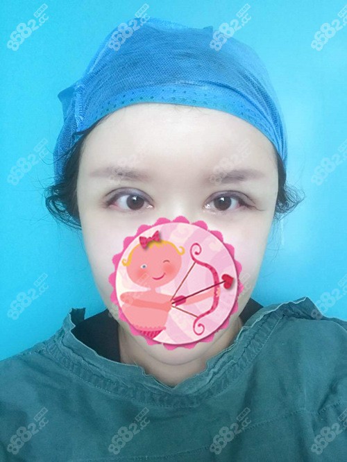 北京眼睛修复医生魏志香眼修复