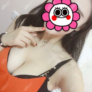 找王沛森院长做脂肪丰胸术后10个月