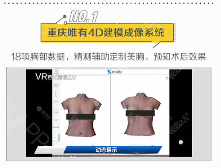 假体很全