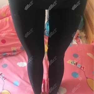 找成都潘红伟医生做大腿吸脂术后1个月
