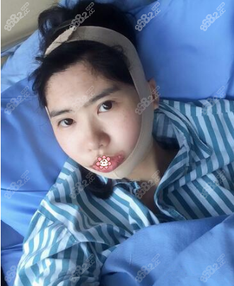 五天后<!--<i data=20240705-sp></i>-->医生让我戴上头套
