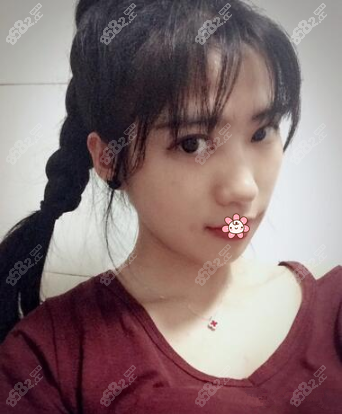 现在我完全成了巴掌小脸