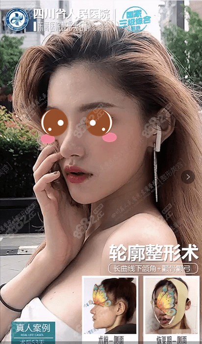成都哪里做面部轮廓整形好
