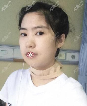 没那么肿了
