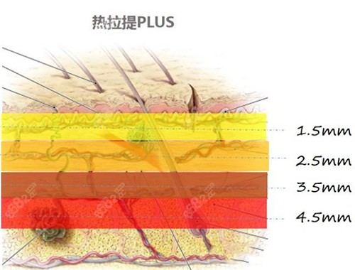 热拉提plus能到达的深度