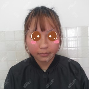 找丁小邦做不明注射物取出前