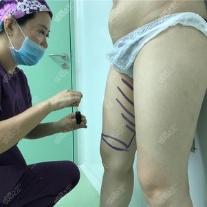 术前设计方案