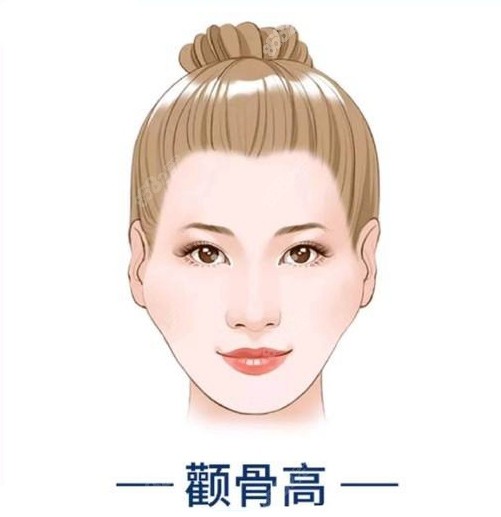 颧骨高造成的菱形脸