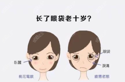 <!--<i data=20240705-sp></i>-->祛眼袋效果怎么样