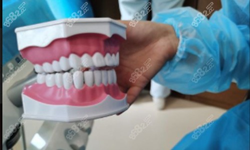 哈尔滨优诺博士口腔牙齿矫正模型