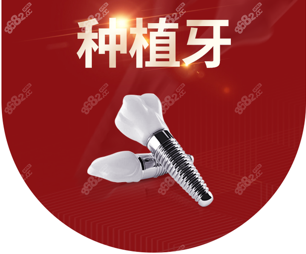 长沙种植牙哪家医院好