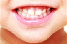 武汉儿童牙科医院前十排名公布，儿牙矫正修复拔牙真不错