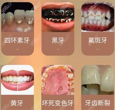 <!--<i data=20240705-sp></i>-->口腔看牙技术好吗
