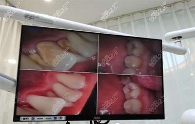 牙齿彩片效果图