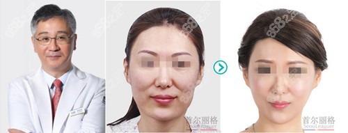 洪性范削骨案例 洪性范削骨案例