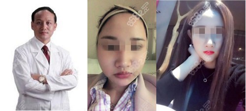 <!--<i data=20240705-sp></i>-->削骨案例 <!--<i data=20240705-sp></i>-->削骨案例