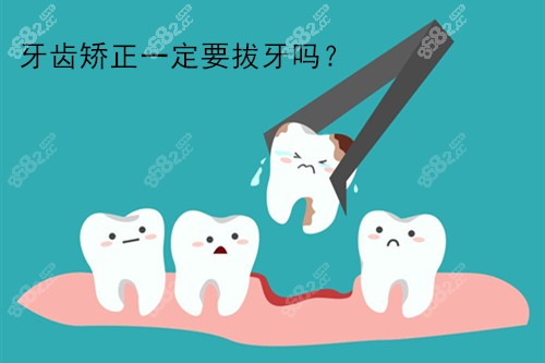 牙齿矫正一定要拔牙吗？